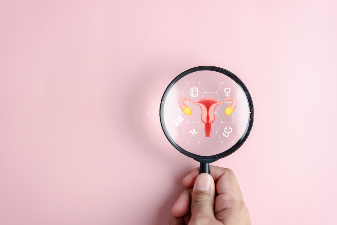 Managing PCOS Hair Growth: How Laser Hair Removal Can Help You Gain Control 2 Managing PCOS Hair Growth 1